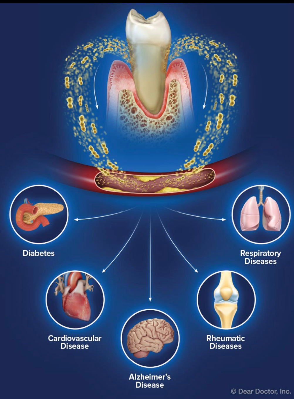 Healthy Mouth Means Healthy Body: Myths and The Truth.