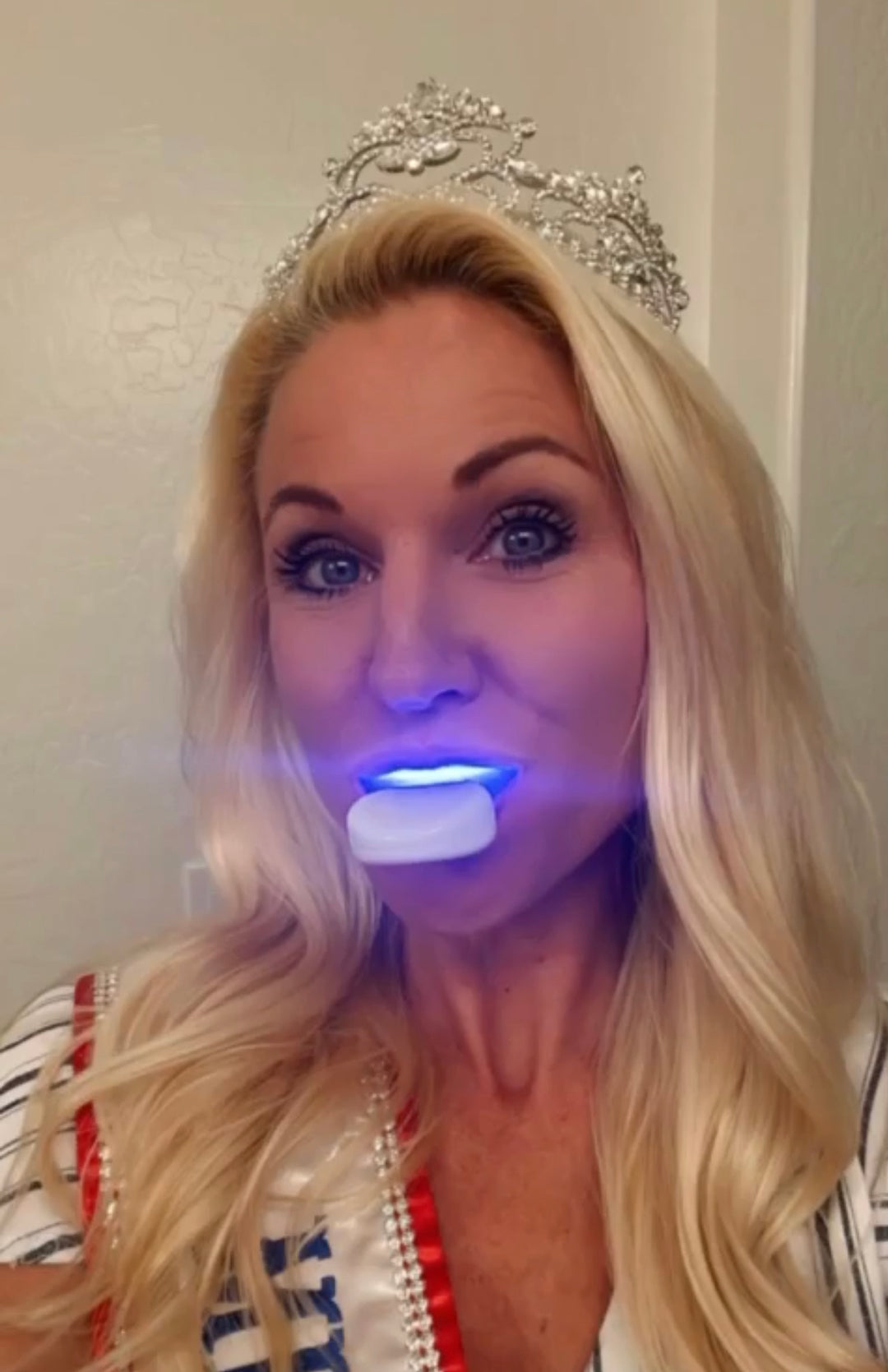 Triple Function LED Light Teeth Whitening: A Revolution in Dental Care