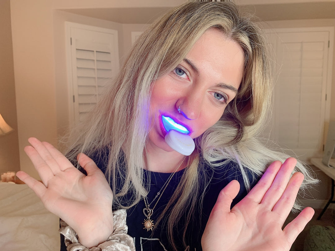 Best Teeth Whitening Solutions