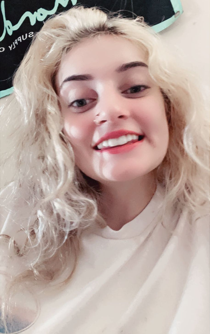 Rachel's beautiful smile with white teeth