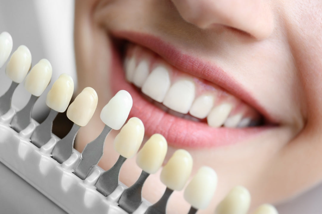 Breaking The Stigma: The Truth About Teeth Whitening